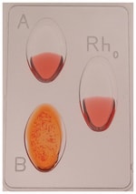 Thumbnail_Innovating Science Blood Typing Kits with Simulated Blood ABO blood typing:Education