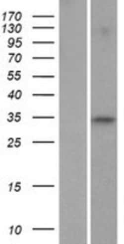 Novus Biologicals&trade;&nbsp;FAM110C Overexpression Lysate
