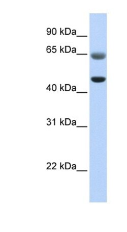 FAM113A Antibody, Novus Biologicals:Antibodies:Primary Antibodies