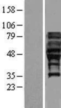 Novus Biologicals&trade;&nbsp;FAM113A Overexpression Lysate
