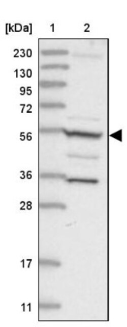 FAM114A2 Antibody, Novus Biologicals 0.1mL; Unlabeled:Antibodies, Polyclonal
