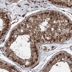 FAM114A2 Antibody, Novus Biologicals 0.1mL; Unlabeled:Antibodies, Polyclonal