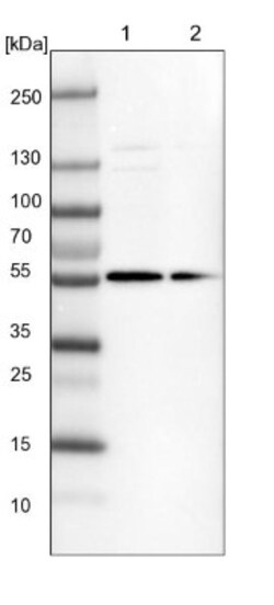 FAM116B Antibody, Novus Biologicals 0.1mL; Unlabeled:Antibodies, Polyclonal