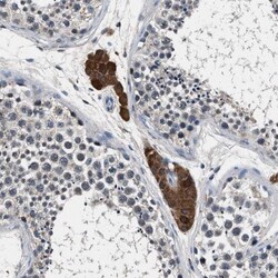 FAM116B Antibody, Novus Biologicals 0.1mL; Unlabeled:Antibodies, Polyclonal