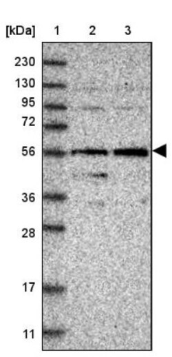 FAM116B Antibody, Novus Biologicals 0.1mL; Unlabeled:Antibodies, Polyclonal