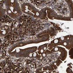 FAM117A Antibody, Novus Biologicals:Antibodies:Primary Antibodies