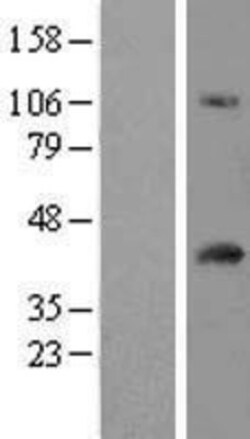 Novus Biologicals&trade;&nbsp;FAM118A Overexpression Lysate