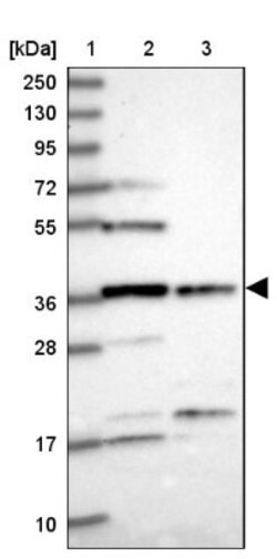 FAM118B Antibody, Novus Biologicals:Antibodies:Primary Antibodies