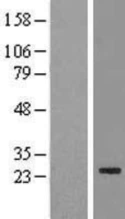 Novus Biologicals&trade;&nbsp;FAM119B Overexpression Lysate