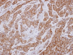 FAM120A Antibody, Novus Biologicals 0.1mL; Unlabeled:Antibodies, Polyclonal