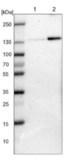 FAM120A Antibody, Novus Biologicals 0.1mL; Unlabeled:Antibodies, Polyclonal
