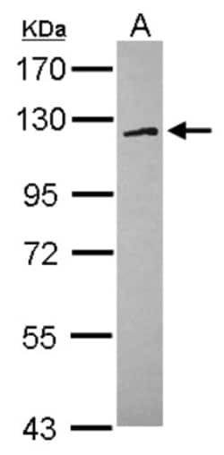 FAM120A Antibody, Novus Biologicals 0.1mL; Unlabeled:Antibodies, Polyclonal