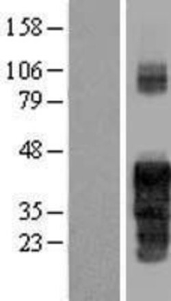 Novus Biologicals™ FAM122A Overexpression Lysate