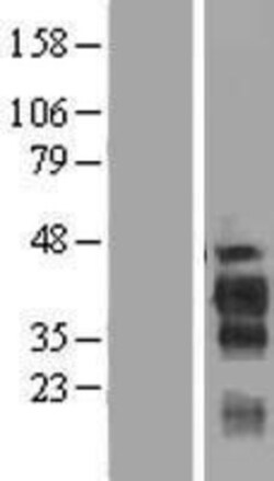 Novus Biologicals&trade;&nbsp;FAM122B Overexpression Lysate