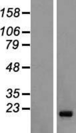 Novus Biologicals&trade;&nbsp;FAM122C Overexpression Lysate