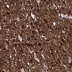 FAM123A Antibody, Novus Biologicals 25 &mu;L, Unlabeled:Antibodies, Polyclonal