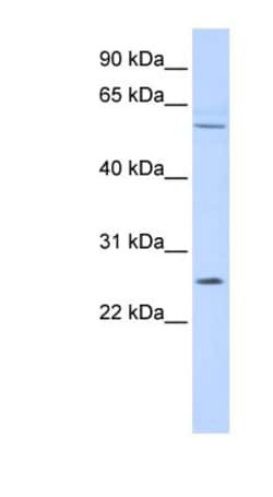 FAM124A Antibody, Novus Biologicals 100 &mu;L | Buy Online | Novus Biologicals | Fisher Scientific