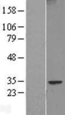 Novus Biologicals&trade;&nbsp;FAM124B Overexpression Lysate
