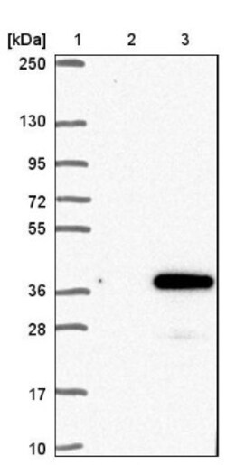 FAM125A Antibody, Novus Biologicals 25 &mu;L, Unconjugated:Antibodies,