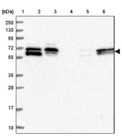 FAM126B Antibody, Novus Biologicals 25 &mu;L | Buy Online | Novus Biologicals | Fisher Scientific