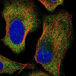 FAM130A1 Antibody, Novus Biologicals 25 &mu;L; Unlabeled:Antibodies, Polyclonal