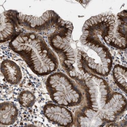 FAM130A1 Antibody, Novus Biologicals 25 &mu;L; Unlabeled:Antibodies, Polyclonal
