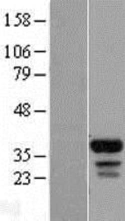 Novus Biologicals&trade;&nbsp;FAM133B Overexpression Lysate
