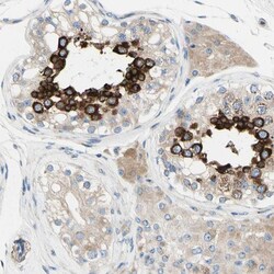 FAM134A Antibody, Novus Biologicals 0.1mL; Unlabeled:Antibodies, Polyclonal
