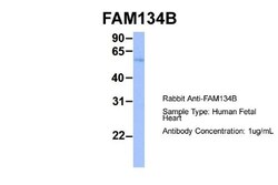 FAM134B Antibody, Novus Biologicals 20&mu;L; Unlabeled:Antibodies, Polyclonal
