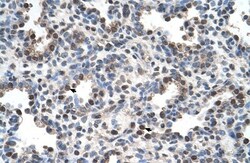 FAM134B Antibody, Novus Biologicals 0.1mg; Unlabeled:Antibodies, Polyclonal
