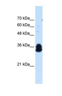 FAM134B Antibody, Novus Biologicals 0.1mg; Unlabeled:Antibodies, Polyclonal