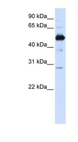 FAM134B Antibody, Novus Biologicals 20&mu;L; Unlabeled:Antibodies, Polyclonal