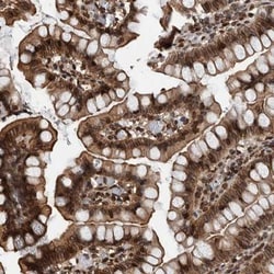 FAM135B Antibody, Novus Biologicals 25 &mu;L; Unlabeled:Antibodies, Polyclonal