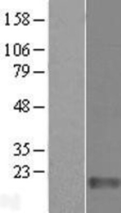 Novus Biologicals&trade;&nbsp;FAM136A Overexpression Lysate
