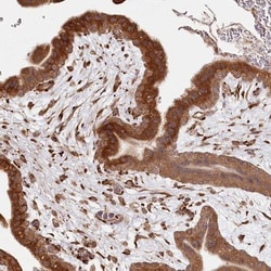 FAM13A Antibody, Novus Biologicals 0.1 mL | Buy Online | Novus Biologicals | Fisher Scientific