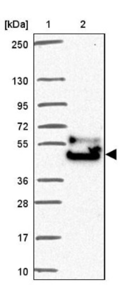 FAM149A Antibody, Novus Biologicals 25 &mu;L, Unlabeled:Antibodies, Polyclonal