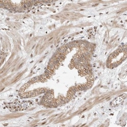 FAM150A Antibody, Novus Biologicals 25 &mu;L; Unlabeled:Antibodies, Polyclonal