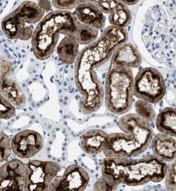 FAM151A Antibody, Novus Biologicals 0.1mL; Unlabeled:Antibodies, Polyclonal