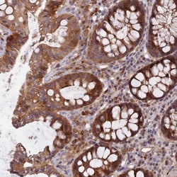 FAM151B Antibody, Novus Biologicals:Antibodies:Primary Antibodies