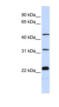 FAM153B Antibody, Novus Biologicals 100&mu;L; Unlabeled:Antibodies, Polyclonal