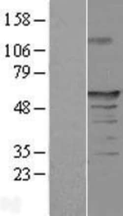 Novus Biologicals&trade;&nbsp;FAM154A Overexpression Lysate