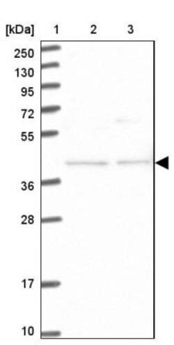 FAM154B Antibody, Novus Biologicals 25 &mu;L | Buy Online | Novus Biologicals | Fisher Scientific
