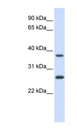 FAM156A Antibody, Novus Biologicals:Antibodies:Primary Antibodies