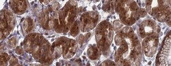 FAM160B1 Antibody, Novus Biologicals 25 &mu;L | Buy Online | Novus Biologicals | Fisher Scientific