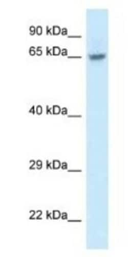 FAM161A Antibody, Novus Biologicals 100&mu;L; Unlabeled:Antibodies, Polyclonal