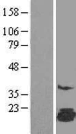 Novus Biologicals&trade;&nbsp;FAM162A Overexpression Lysate