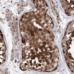 FAM162B Antibody, Novus Biologicals 0.1 mL | Buy Online | Novus Biologicals | Fisher Scientific