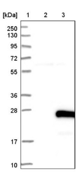 FAM163A Antibody, Novus Biologicals 0.1mL; Unlabeled:Antibodies, Polyclonal