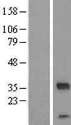 Novus Biologicals&trade;&nbsp;FAM164C Overexpression Lysate