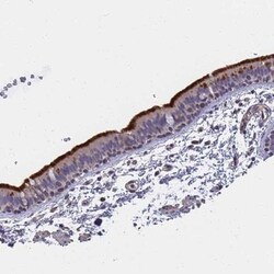 FAM166B Antibody, Novus Biologicals:Antibodies:Primary Antibodies